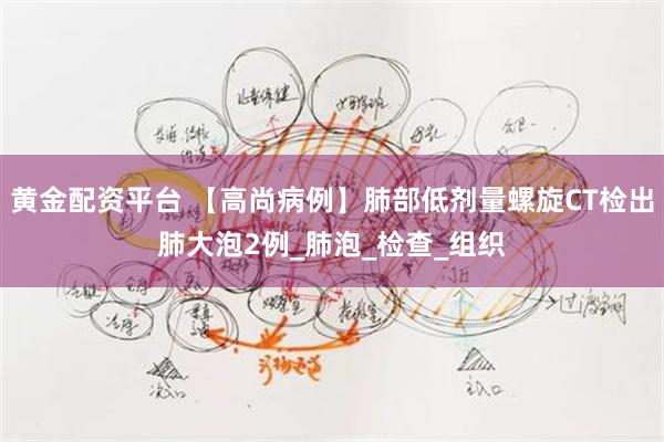 黄金配资平台 【高尚病例】肺部低剂量螺旋CT检出肺大泡2例_肺泡_检查_组织